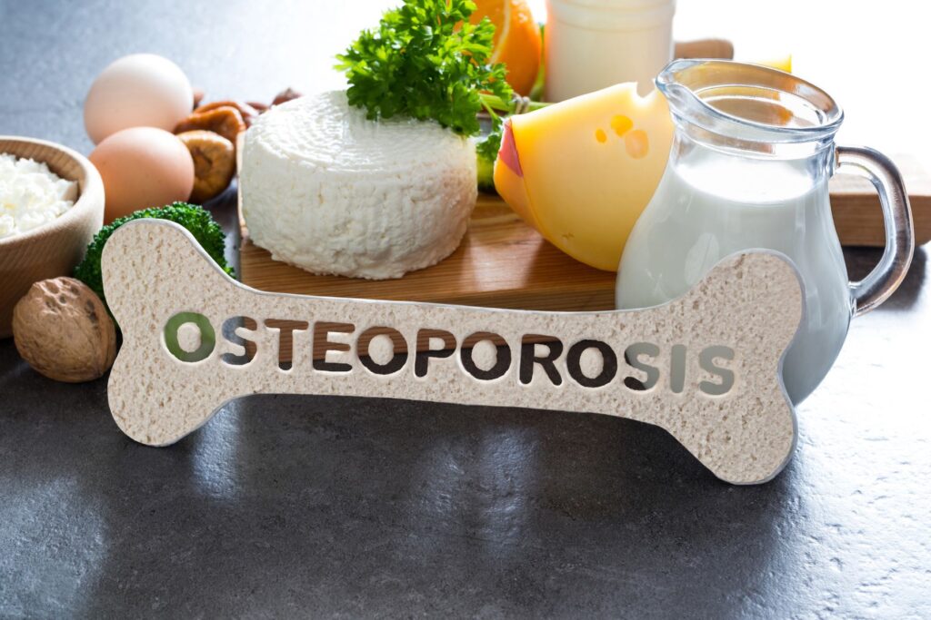 osteoporosis treatment atlantis physical therapy torrance redondo beach palos verdes south bay